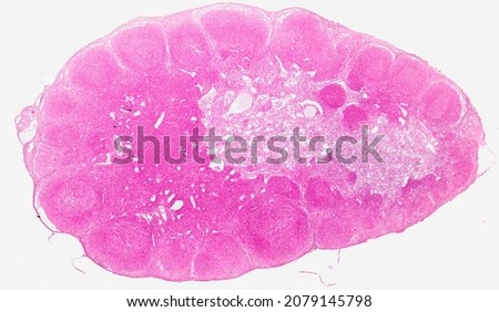Histological section of a lymph node stained with hematoxylin and eosin.