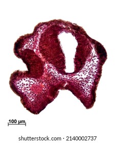 Histological Section Shows The Development Of The Nervous System In The Tadpole Frog. The Neural Tube Has A Cavity And Is Located In The Center. Hematoxylin And Eosin Staining. 