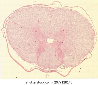 Histological Section Of The Spinal Cord Stained With Hematoxylin And Eosin.