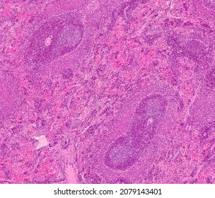 Histological Section Of The Spleen Stained With Hematoxylin And Eosin.