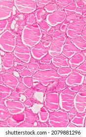Histological section of the thyroid gland stained with hematoxylin and eosin.