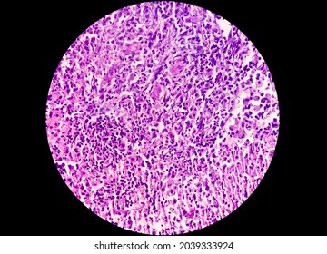 A Histological Slide Of A Tissue Sample. Close Microscopic View. Histopathology