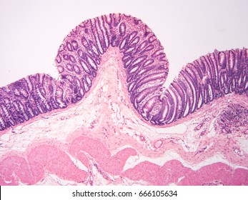 Histology Colon Human Tissue Show Epithelium Stock Photo 666105634 ...