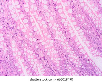 Histology of colon human tissue , show epithelium tissue and connective tissue with microscope view
