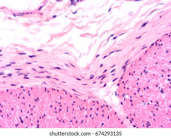 Histology Colon Human Tissue Show Epithelium Stock Photo 674293135 ...