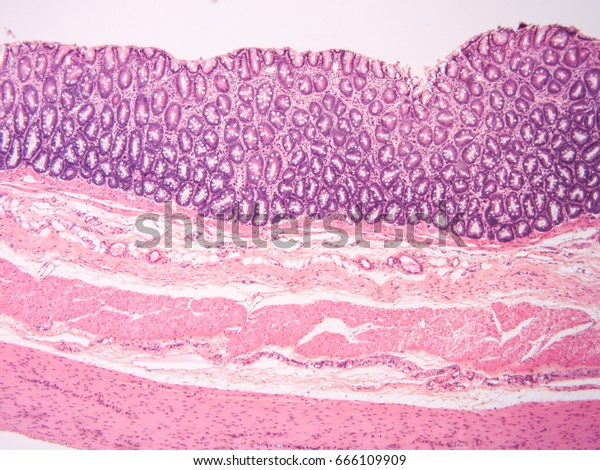 1,168 Colon Histology Images, Stock Photos & Vectors | Shutterstock