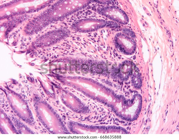 Histology Colon Human Tissue Show Epithelium Stock Photo (Edit Now ...