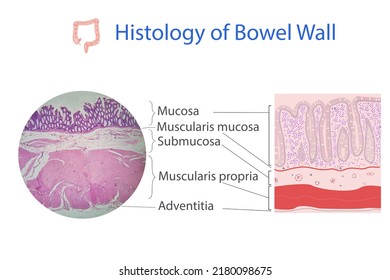 Histology Of Colon Wall In Illustration And Microscopical Photo