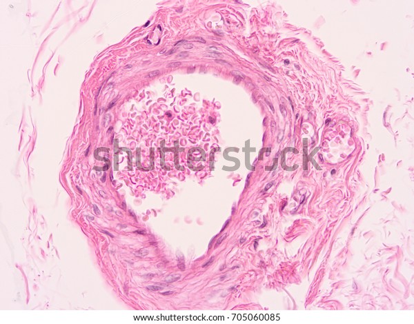 Histology Ductus Deferens Tissue Show Epithelium Stock Photo Edit Now 705060085