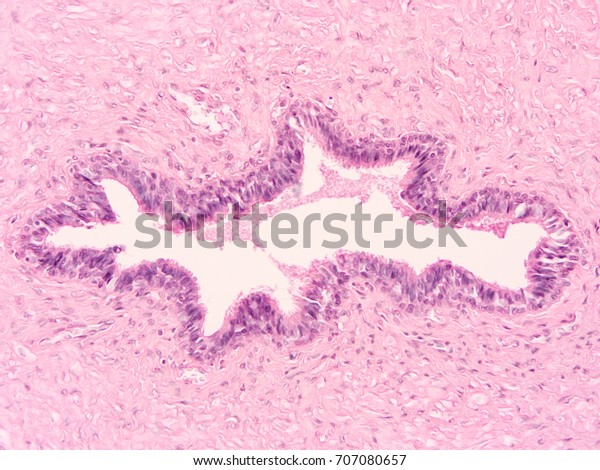 Histology Ductus Deferens Tissue Show Epithelium Stock Photo 707080657 ...