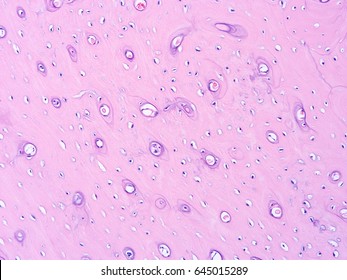 Histology Human Bone Tissue Show Muscle Stock Photo 648551110 ...