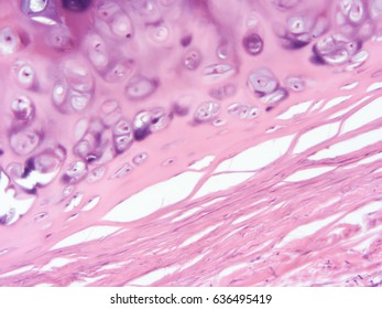 Histology Human Trachea Tissue Show Cartilage Stock Photo 646968886 ...