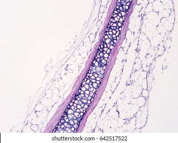 Cartilage Tissue Images, Stock Photos & Vectors 