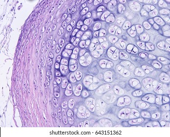Histology of human cartilage connective tissue, show  hyaline and elastic cartilage with microscope view