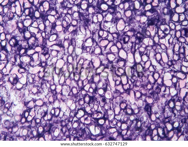 Histology of human\
cartilage connective tissue, show  hyaline and elastic cartilage\
with microscope view