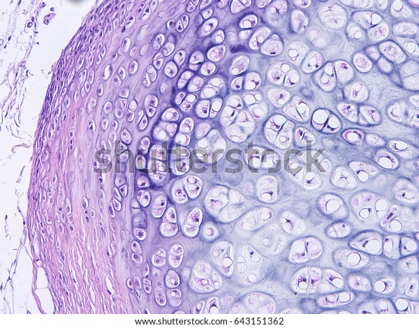 Histology of human\
cartilage connective tissue, show  hyaline and elastic cartilage\
with microscope view