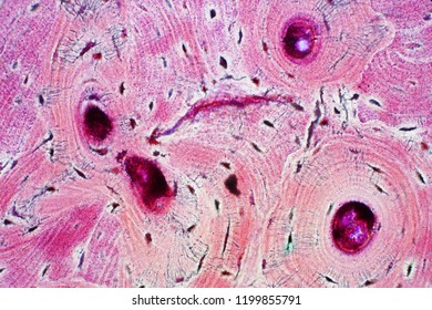 Histology of human compact bone tissue under microscope view for education, muscle bone connection and connective tissue