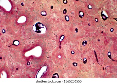 259 Compact Bone Tissue Images, Stock Photos & Vectors | Shutterstock