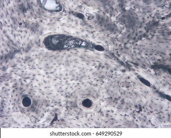 Histology Of Human Compact Bone Tissue, Show Muscle Bone Connection And Connective Tissue With Microscope View