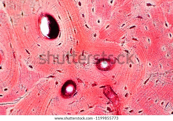 Histology of human compact bone tissue under microscope view for education, muscle bone connection and connective tissue