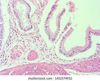 histology of human gallbladder tissue with microscope