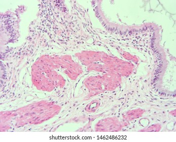 Histology Human Gallbladder Tissue Microscope Stock Photo 1462486232 ...