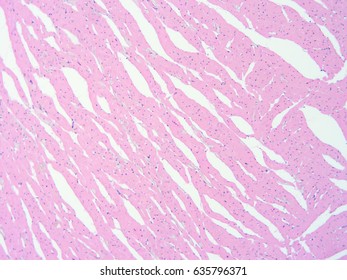 Histology Human Heart Tissue Show Cardiac Stock Photo 635796371 ...