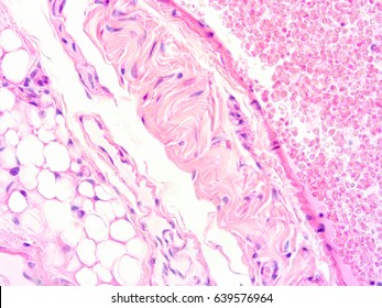 Histology Of Human Heart Tissue, Show Cardiac Muscle Tissue And Connective Tissue With Microscope View