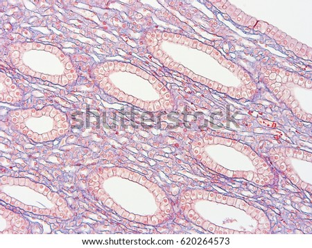 Histology of human intestine, show cuboidal epithelium tissue with microscope view