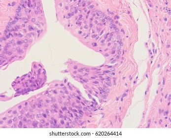 Histology Of Human Intestine, Show Transitional Epithelium Tissue With Microscope View