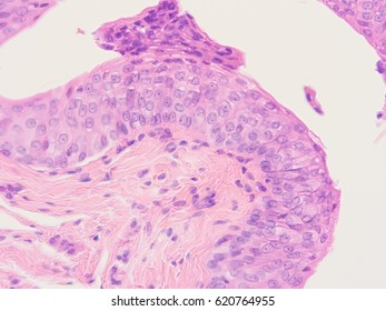 Histology Of Human Intestine, Show Transitional Epithelium Tissue With Microscope View