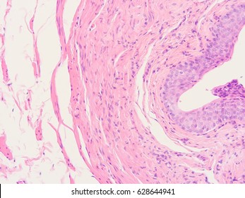 Histology Of Human Intestine, Show Transitional Epithelium Tissue With Microscope View