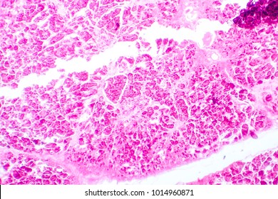 Histology of human pancreatic tissue. Light micrograph of pancreas showing islets where insulin is produced