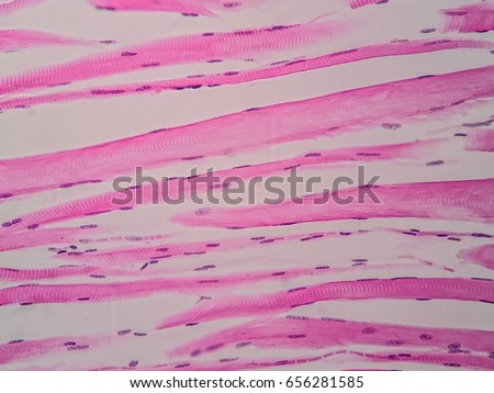 Histology of human skeletal muscle under microscope view
