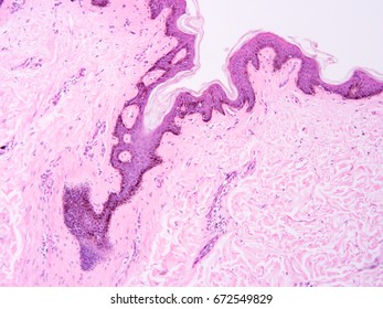 Histology Human Skin Tissue Show Epithelium Stock Photo 675261652 ...