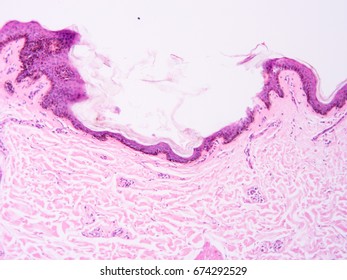 Histology Human Skin Tissue Show Epithelium Stock Photo 674292529 ...