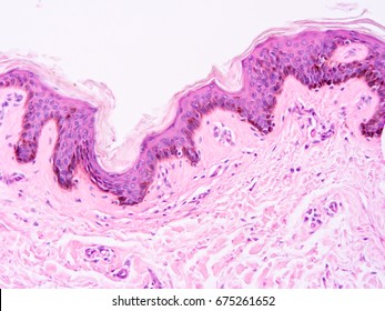 Histology Of Human Skin Tissue , Show Epithelium Tissue And Connective Tissue With Microscope View