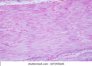 Smooth Muscle Tissue Images Stock Photos Vectors Shutterstock
