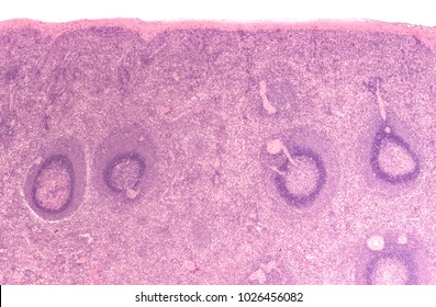 Histology Of The Human Spleen, With Red Pulp And White Pulp.