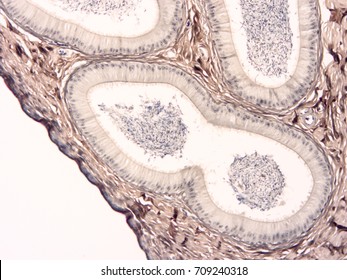 engagement Paine Gillic Hidden Histology Human Testis Epididymis Tissue Show Stock Photo 709240318 |  Shutterstock