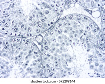 Histology Human Testis Tissue Show Spermatogenesis Stock Photo ...