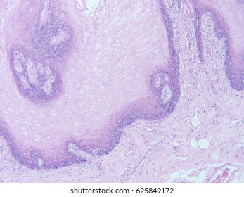 Histology Human Tissue Microscope View Stock Photo 625849172 