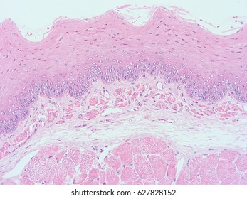 keratinized gingiva histology