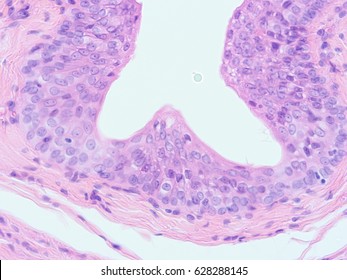 Histology Of Human Tissue , Show Transitional Epithelium Tissue With Microscope View