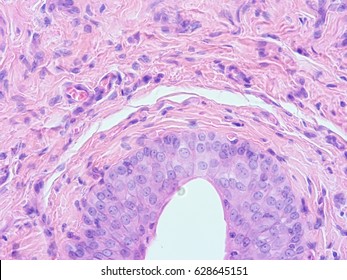 Histology Of Human Tissue , Show Transitional Epithelium Tissue With Microscope View