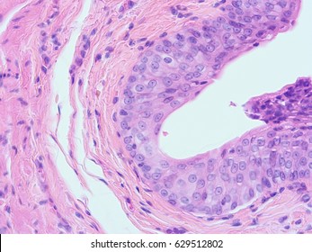 Histology Of Human Tissue , Show Transitional Epithelium Tissue With Microscope View