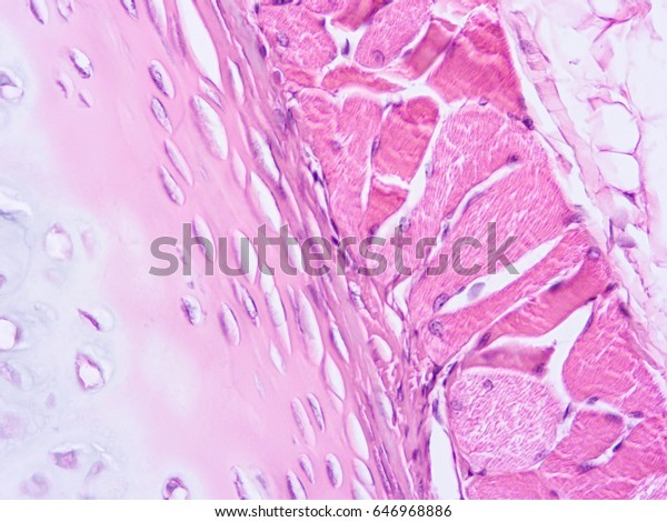 Histology Human Trachea Tissue Show Cartilage Stock Photo 646968886 ...