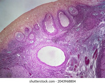 Histology image of ovaries showing oocytes in various stages (40x)