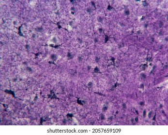Histology microscope image of astrocytes in the brain (400x)
