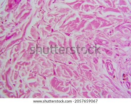 Histology microscope image of dense irregular connective tissue proper in dermis (400x)